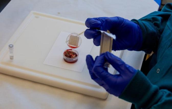 A lymph node sample in a plastic container is prepared for sampling